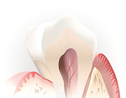Animation of the inside of a healthy tooth after pulp therapy